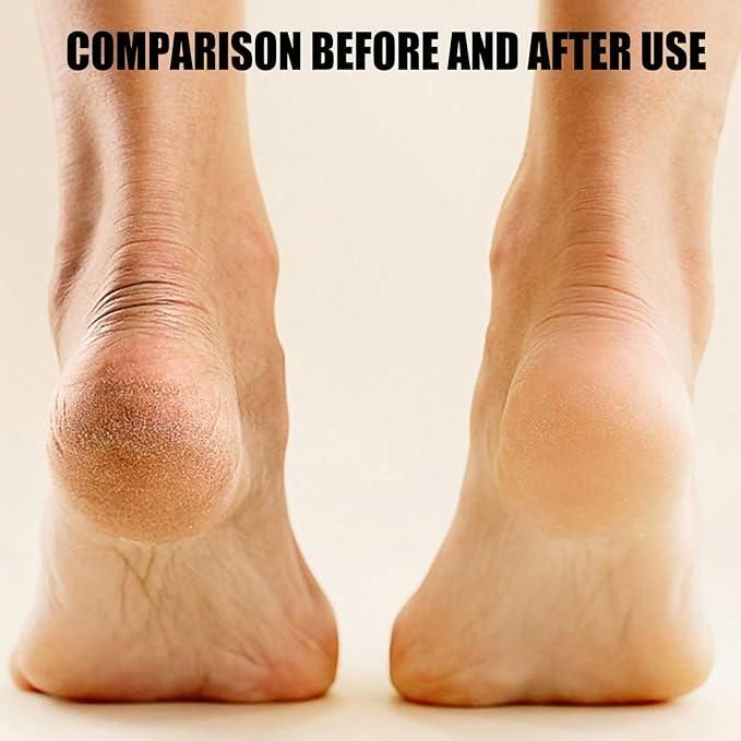 Electronic Pedicure Tool,body glow up product